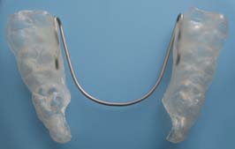 歯の矯正装置